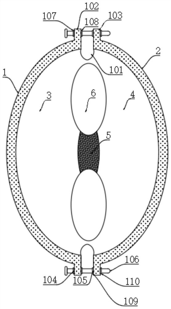 A self-supporting postoperative fixation frame for hip bones