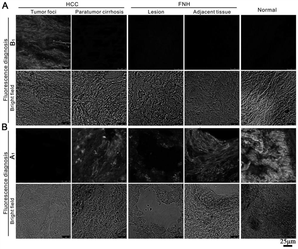 Fluorescent compound and preparation method thereof, and application of fluorescent compound in interactive verification and positioning of liver tumor focus tissue