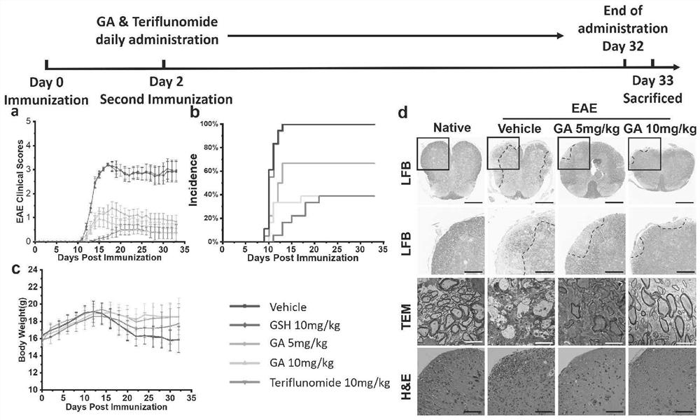 Application of gold complex in preparation of medicine for preventing and/or treating multiple sclerosis