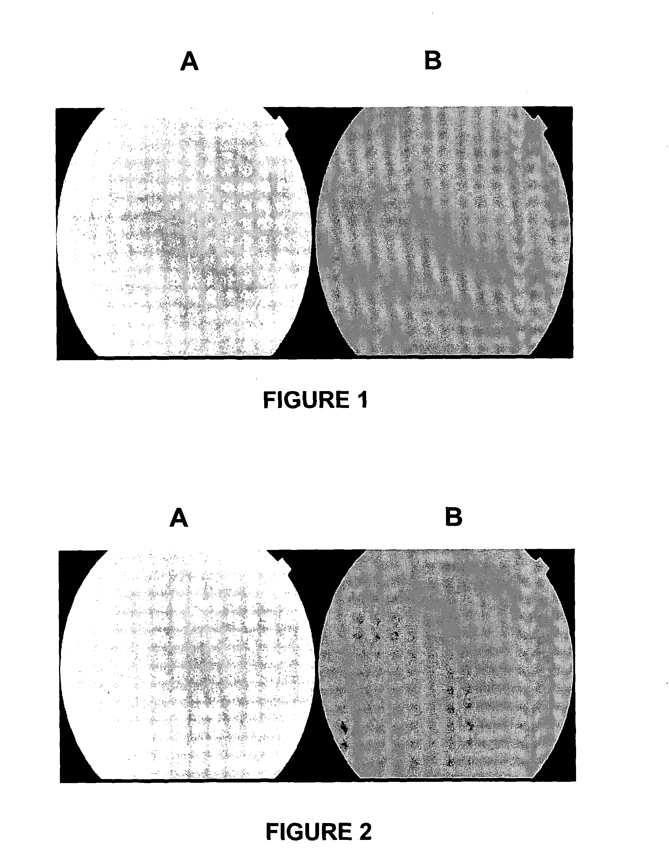 Drug delivery to the anterior and posterior segments of the eye using eye drops