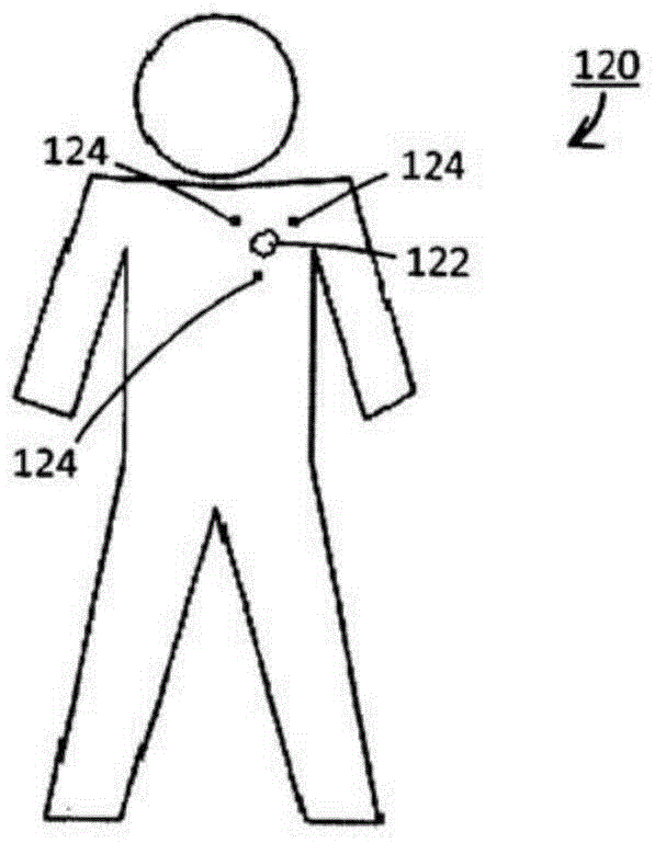 Studying the dosimetric impact of exercise to generate adapted patient-specific margins in EBRT planning