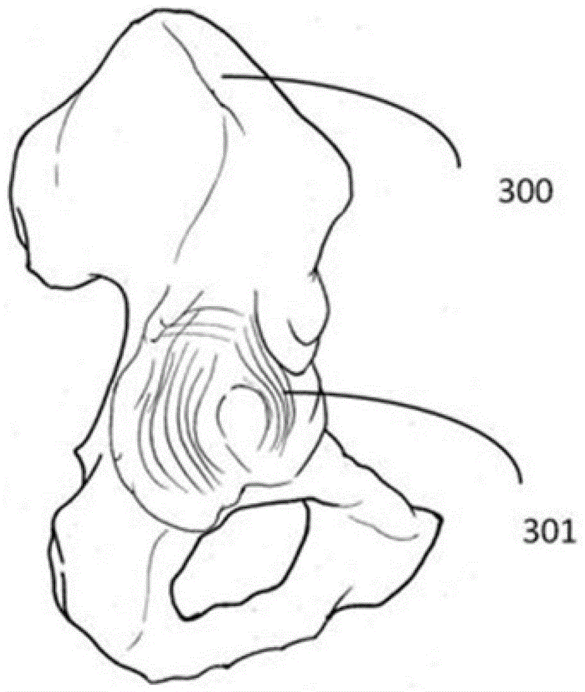 Customized positioning device for hip joint surgery and supporting prosthesis based on medical images