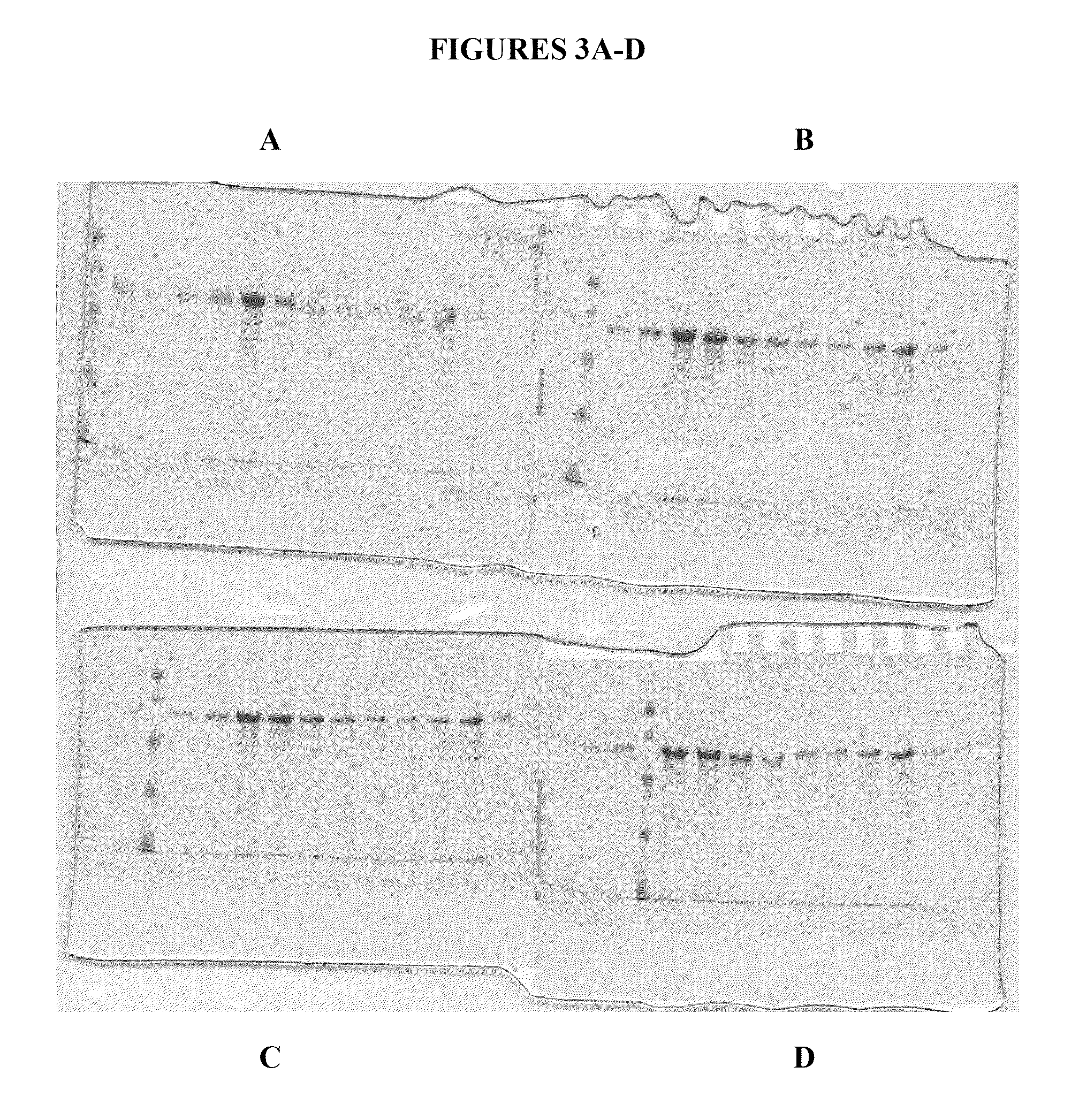 Compositions and methods for purifying calreticulin