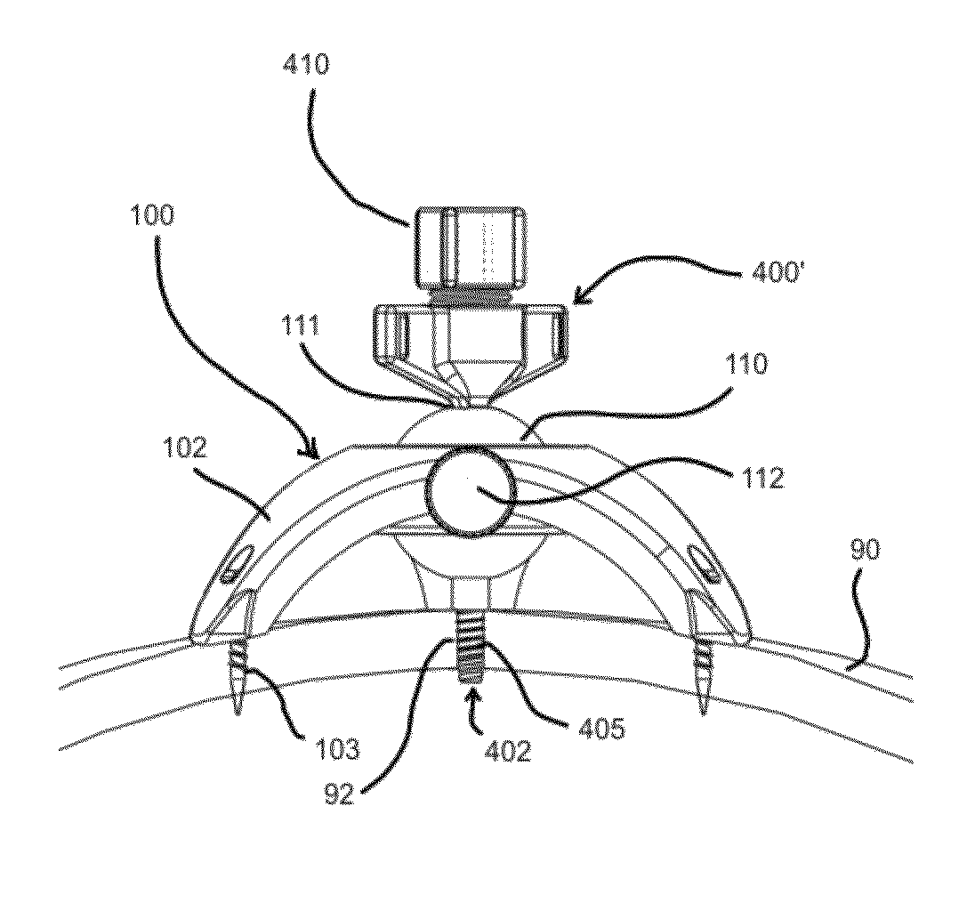 Stereotactic access devices and methods