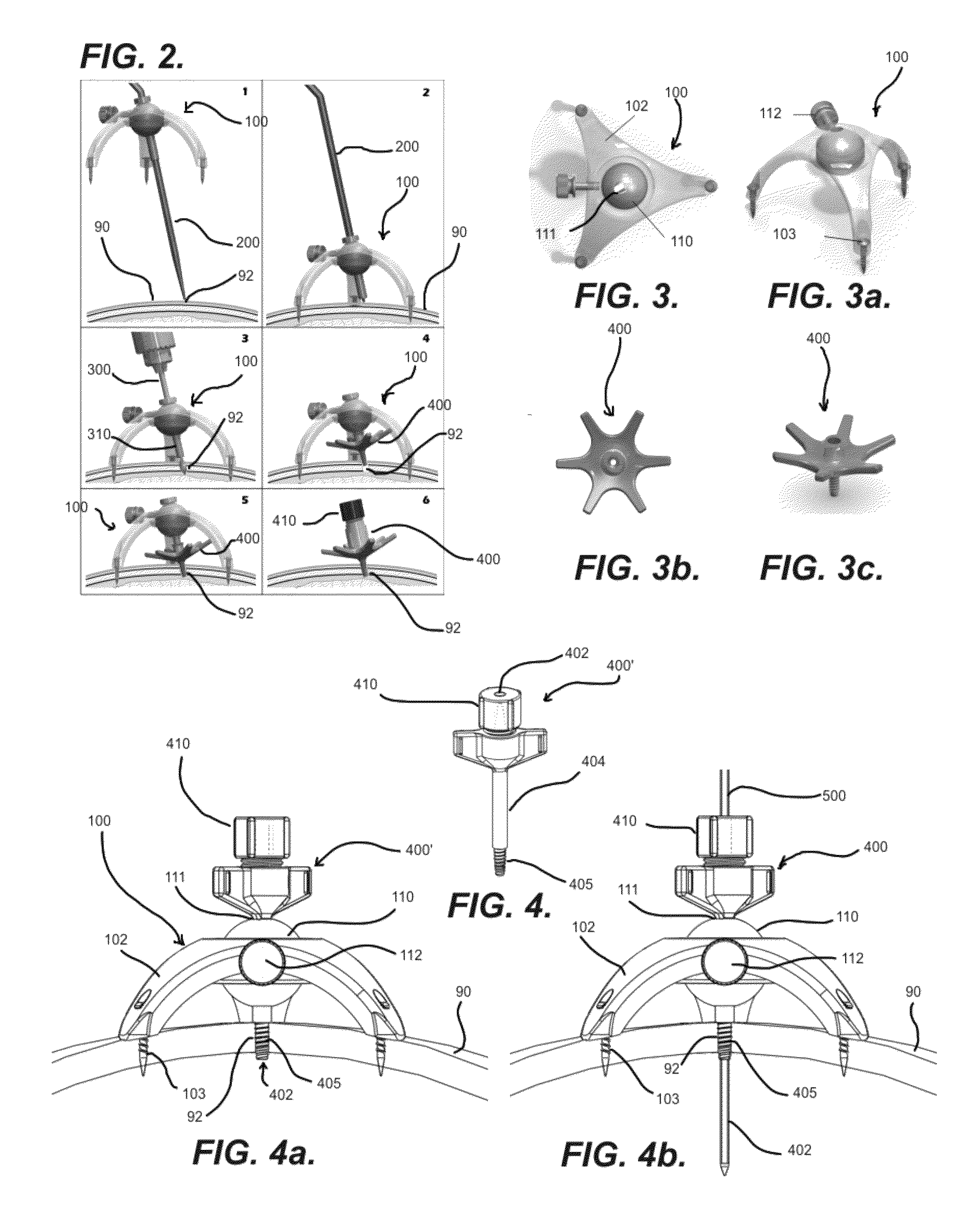 Stereotactic access devices and methods