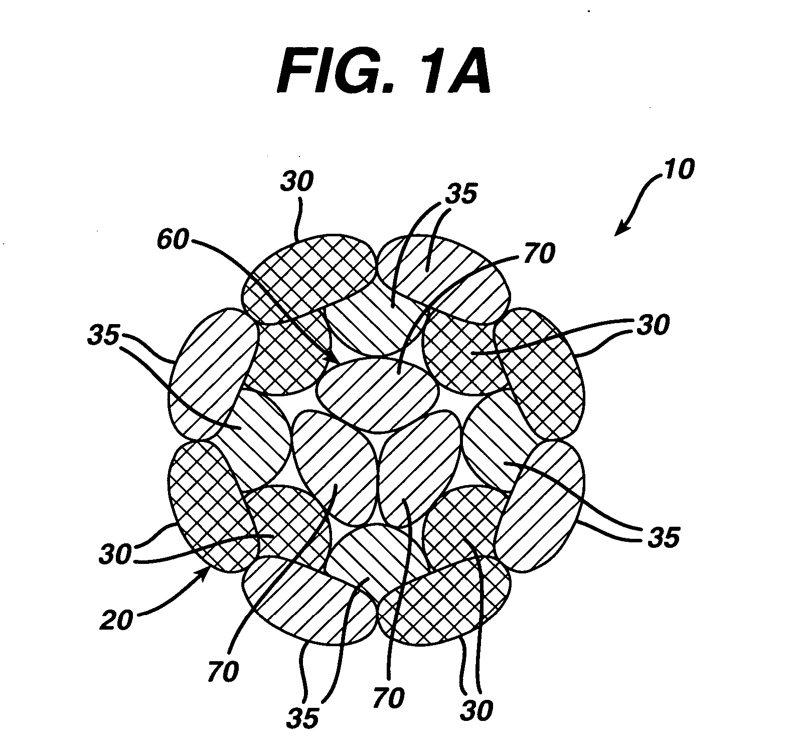 High strength suture with absorbable core