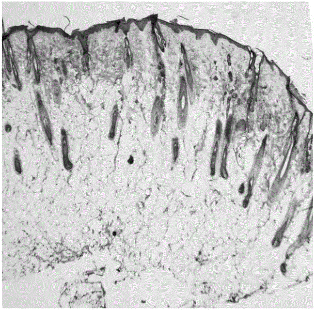 Tissue-engineered epidermis and preparation method thereof