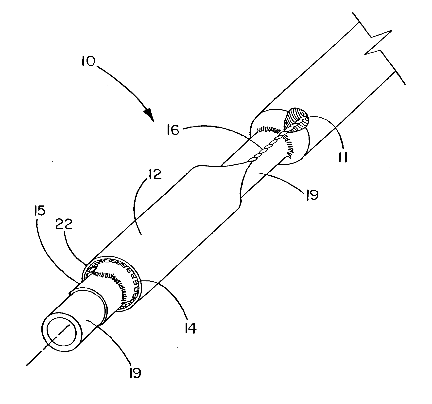 Deployment system for an expandable device