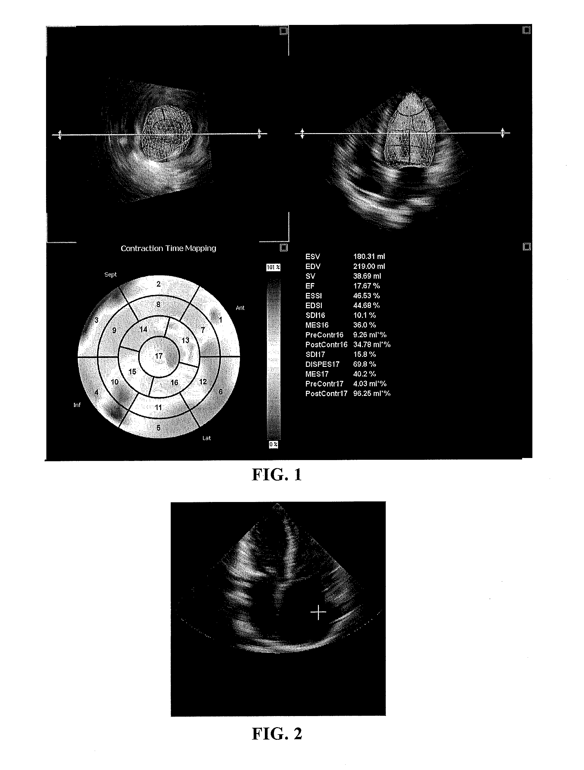 Device and method for determining border of target region of medical images