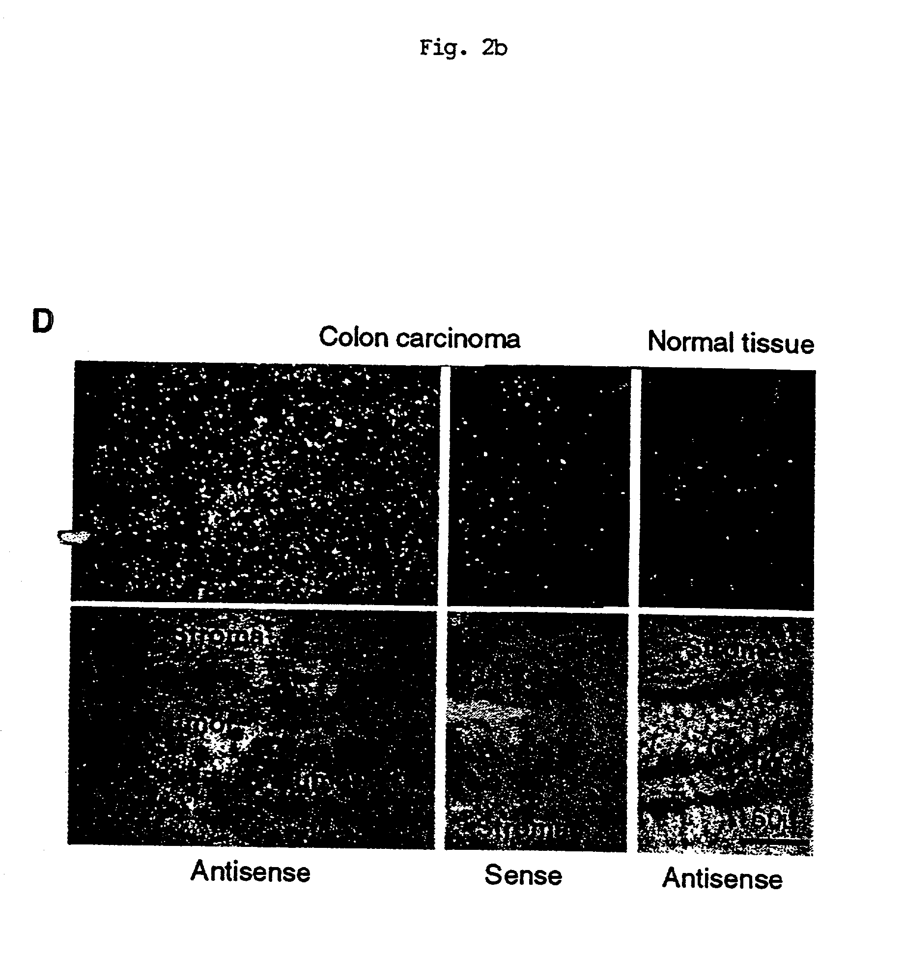 APRIL- a novel protein with growth effects