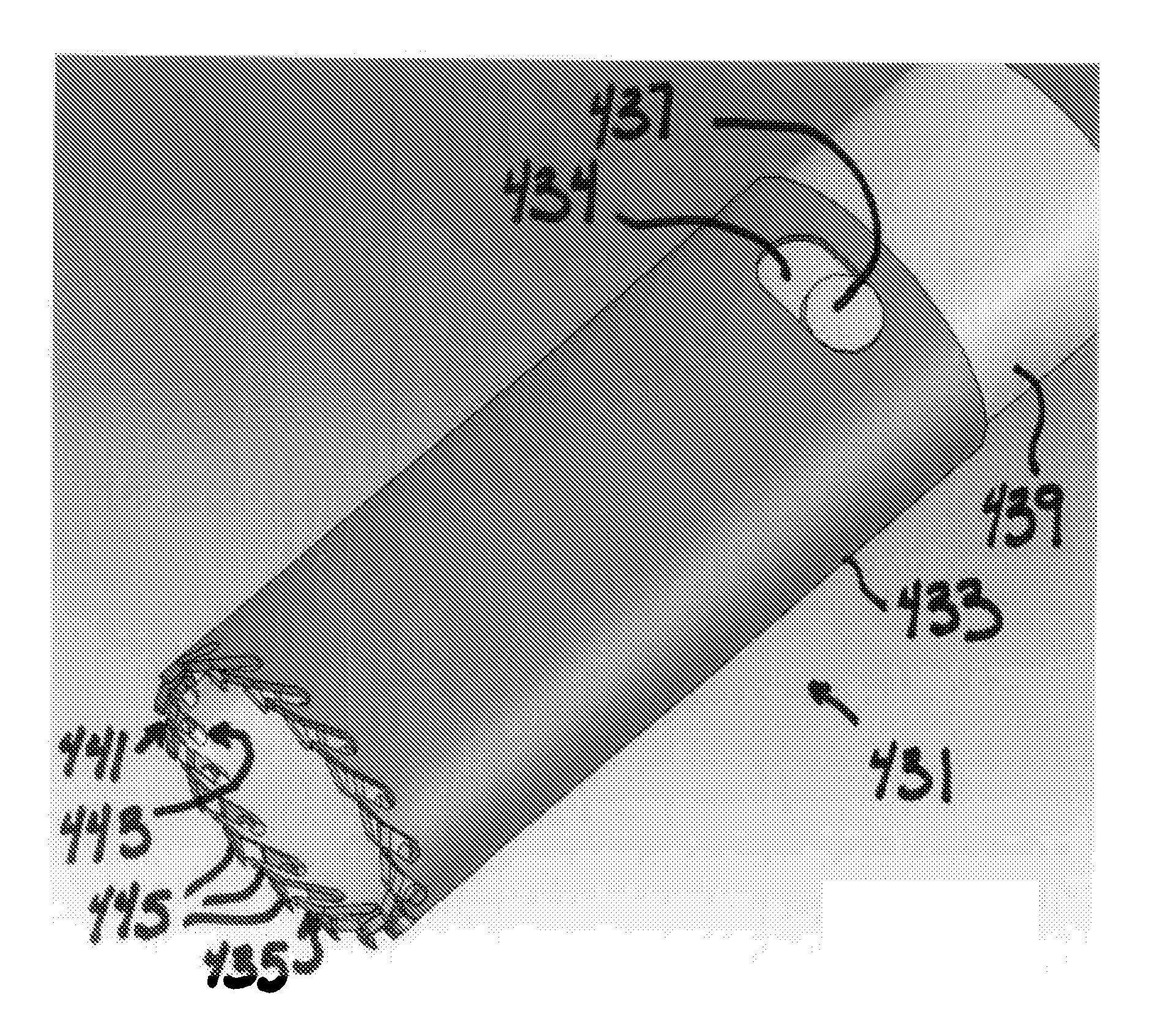 Systems and methods for puncture closure