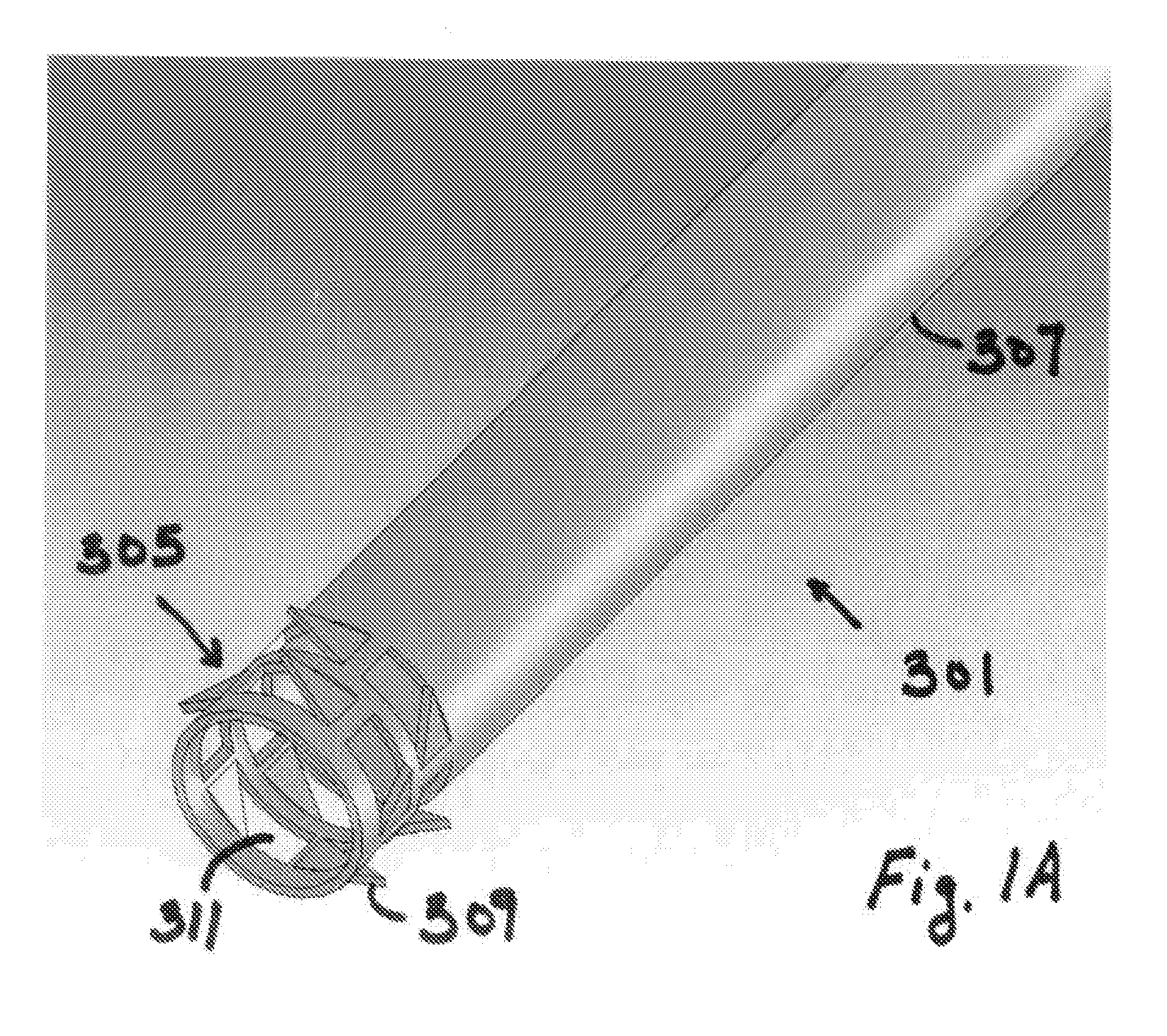 Systems and methods for puncture closure