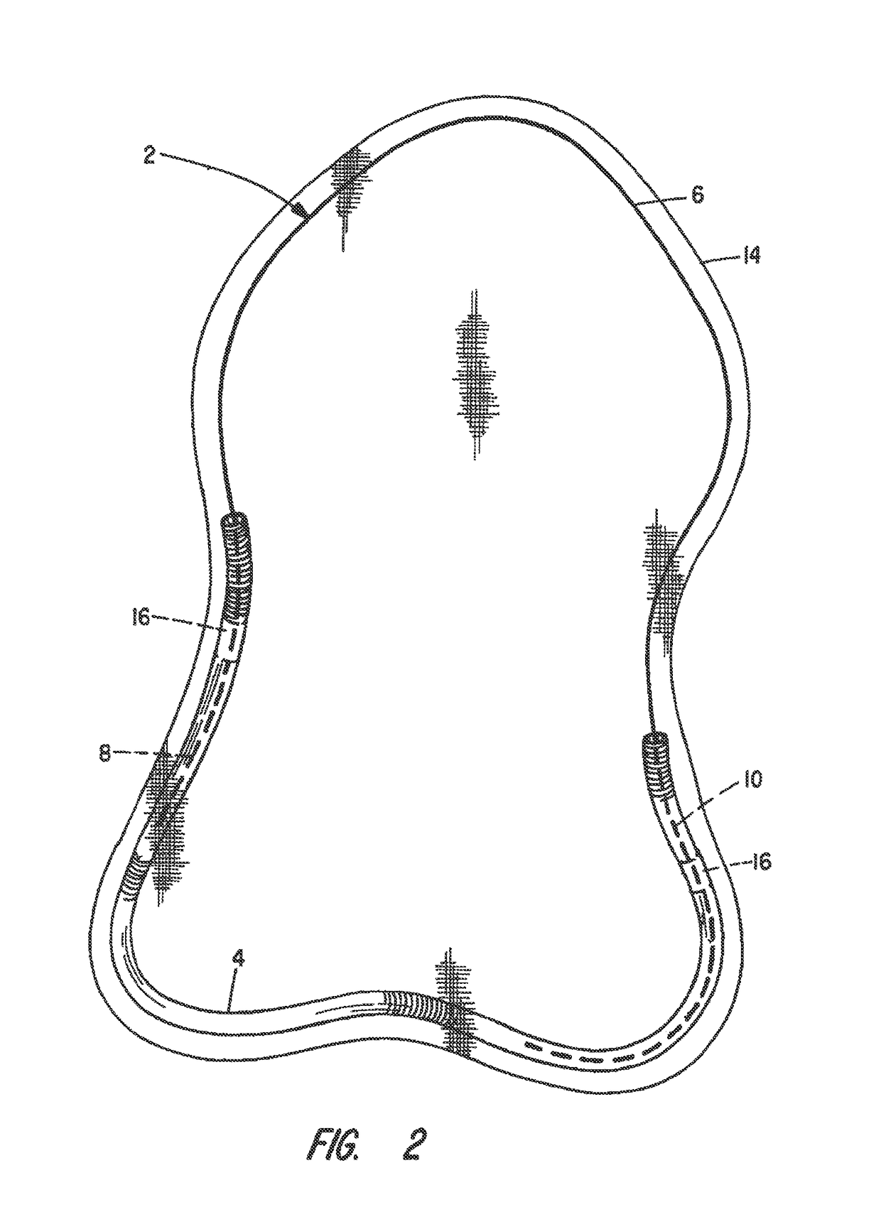 Hernia patch frame incorporating bio-absorbable material