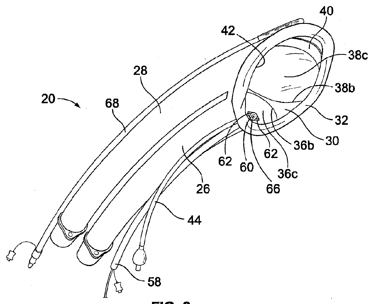 Airway device, airway assist device and the method of using same