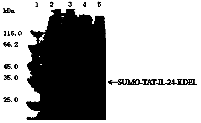 TAT-IL-24-KDEL fusion protein as well as preparation method and application thereof