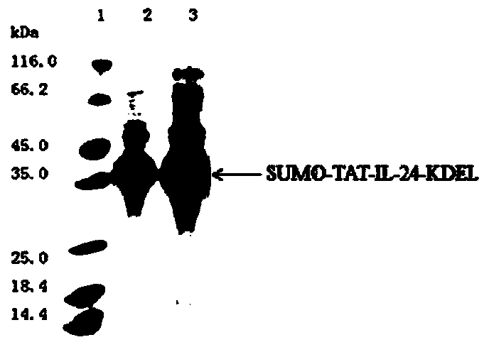 TAT-IL-24-KDEL fusion protein as well as preparation method and application thereof