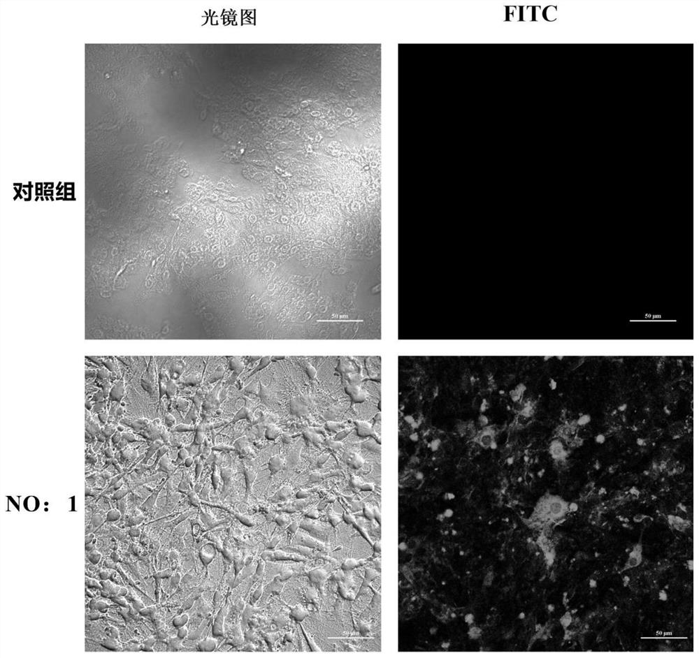 Nucleic acid aptamer and its application in the detection of neuronecrosis virus derived from pompano ovata