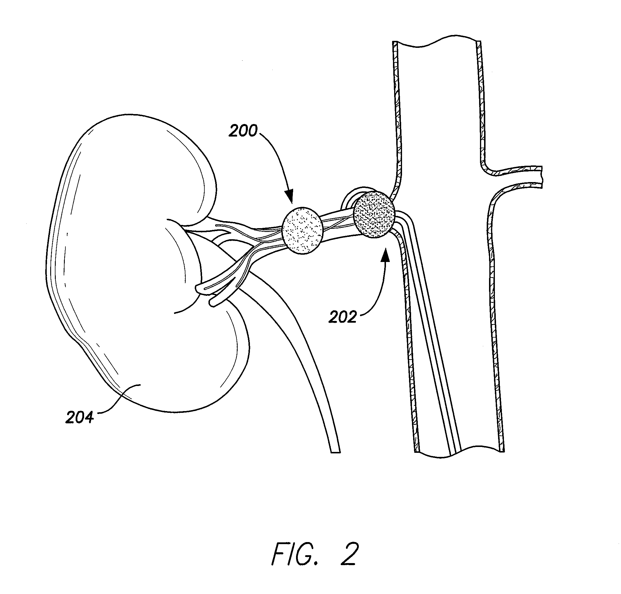 System and method for performing renal denervation verification