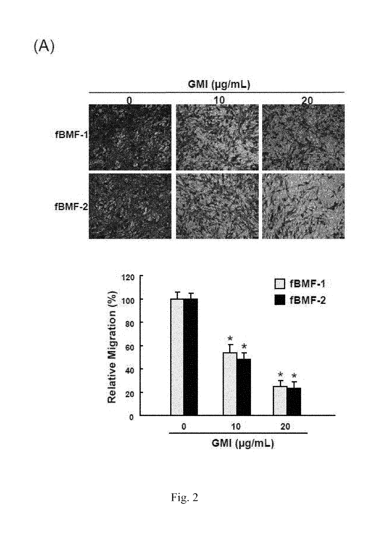 Use of immunomodulatory protein from ganoderma in inhibiting fibrosis