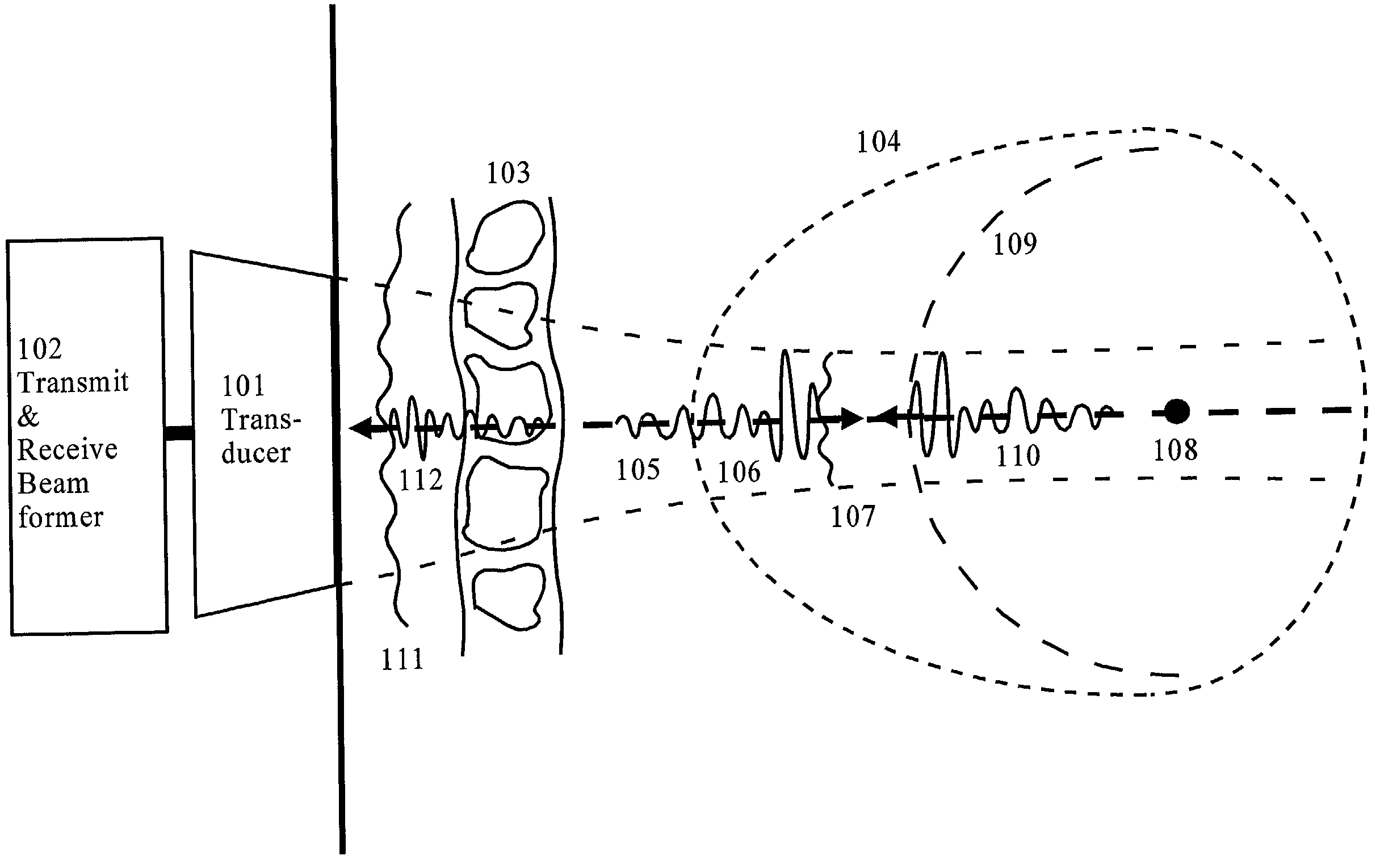 Correction of phasefront aberrations and pulse reverberations in medical ultrasound imaging