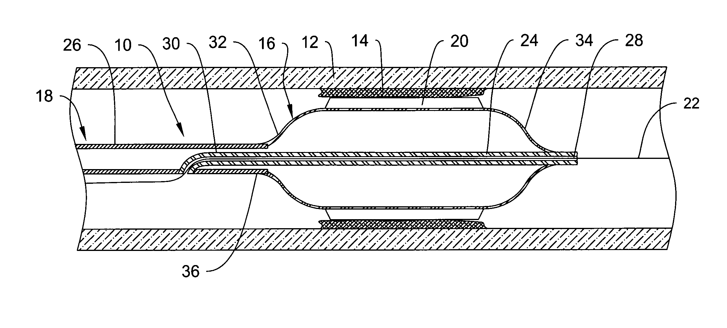 Cutting balloon catheter and method for blade mounting