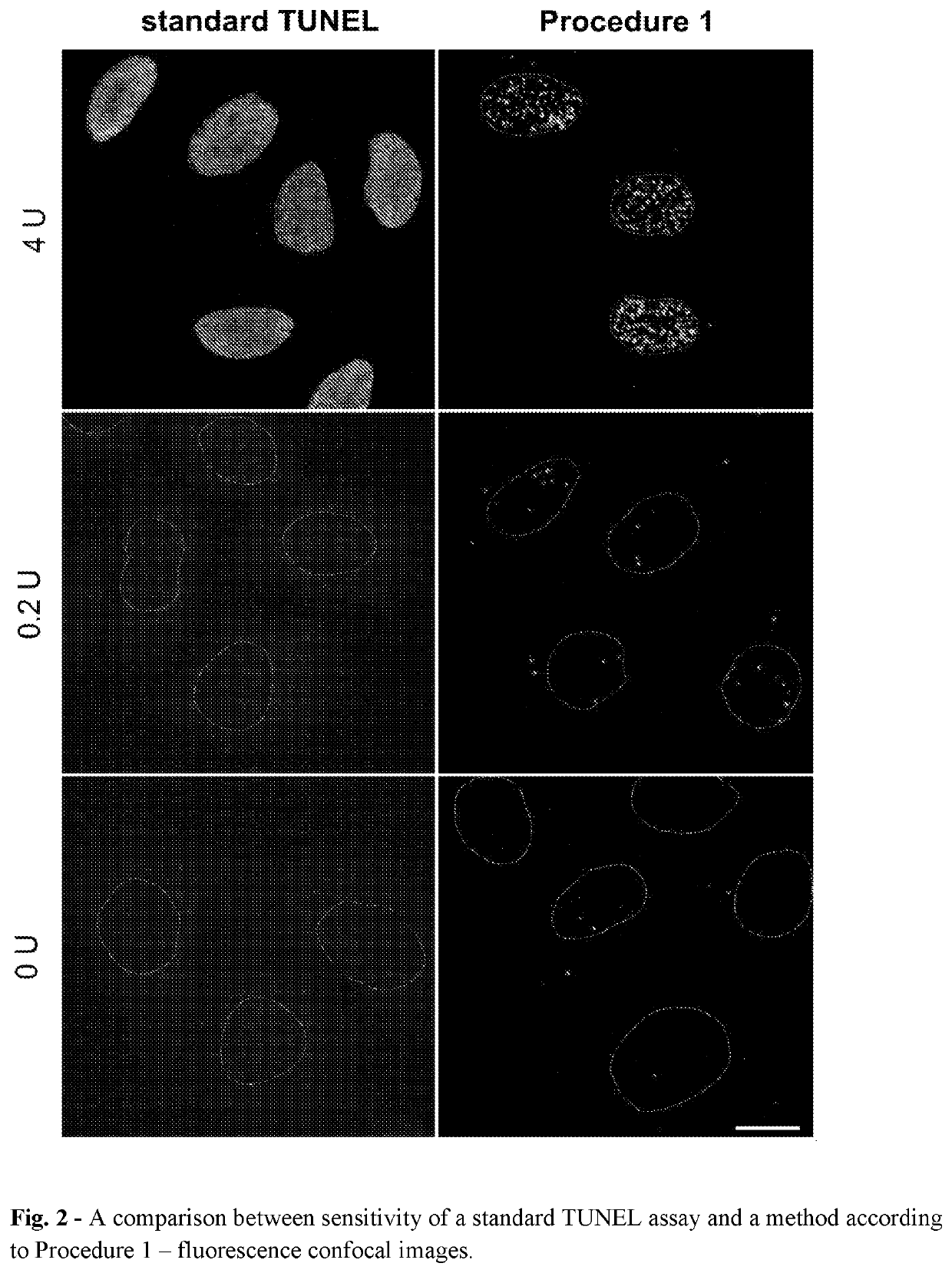 Method of detection of DNA end(s) and its use