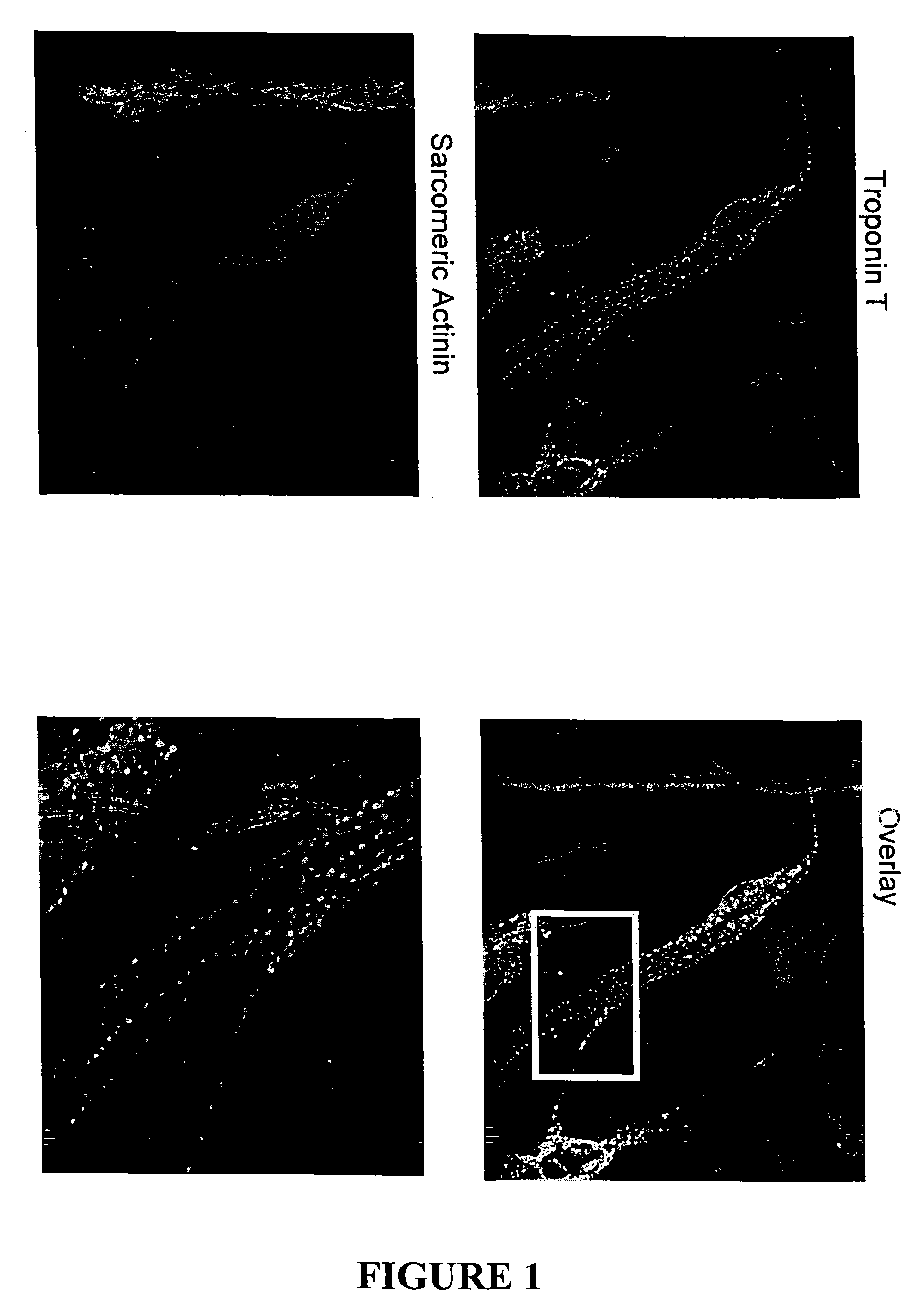 Differentiation of human mesenchymal stem cells to cardiac progenitor cells that promote cardiac repair