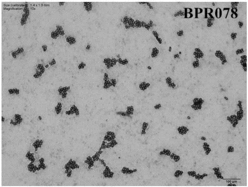 A rhizosphere growth-promoting Bacillus arzii for blueberries and its application