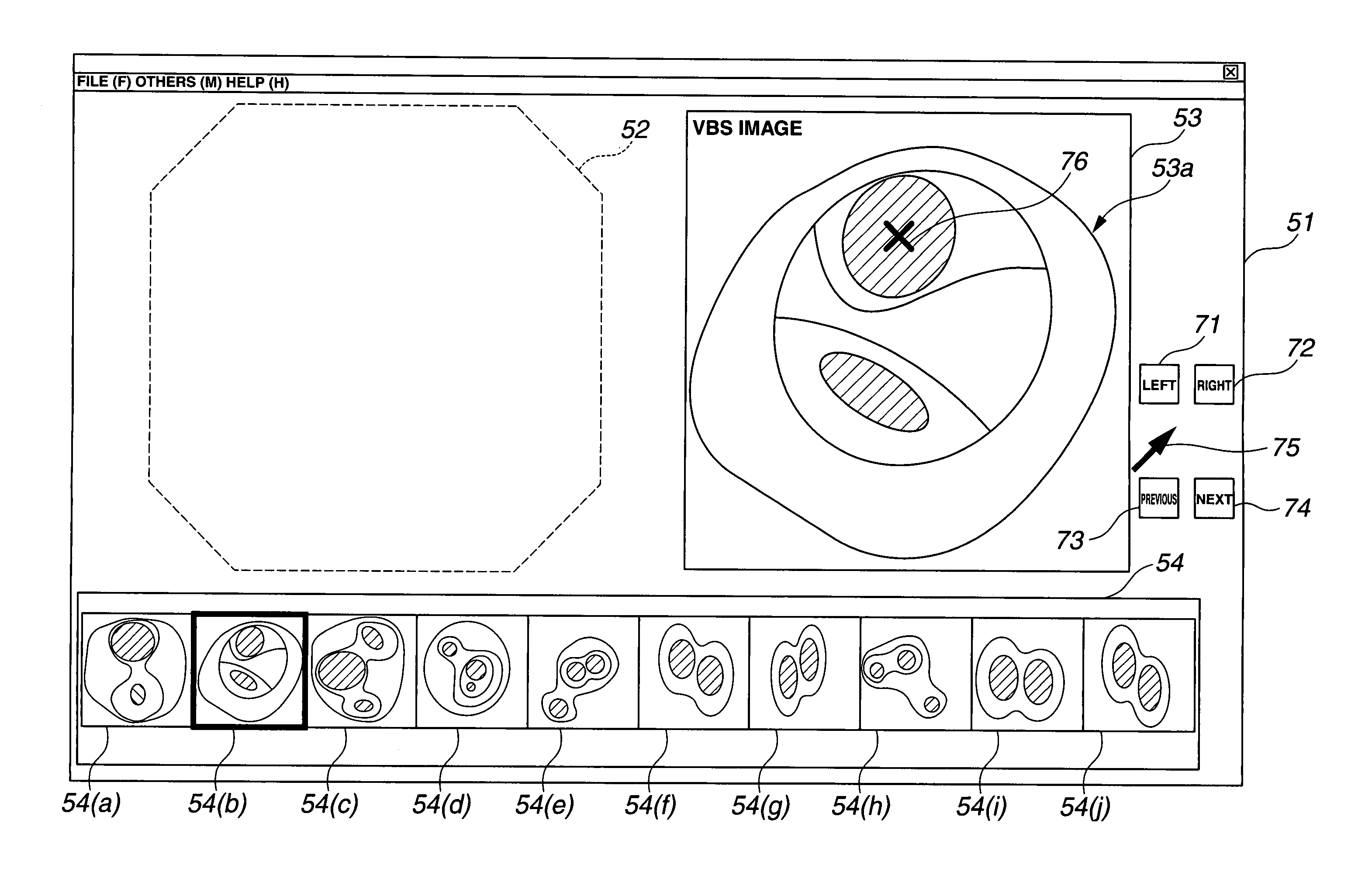 Insertion support system for producing imaginary endoscopic image and supporting insertion of bronchoscope