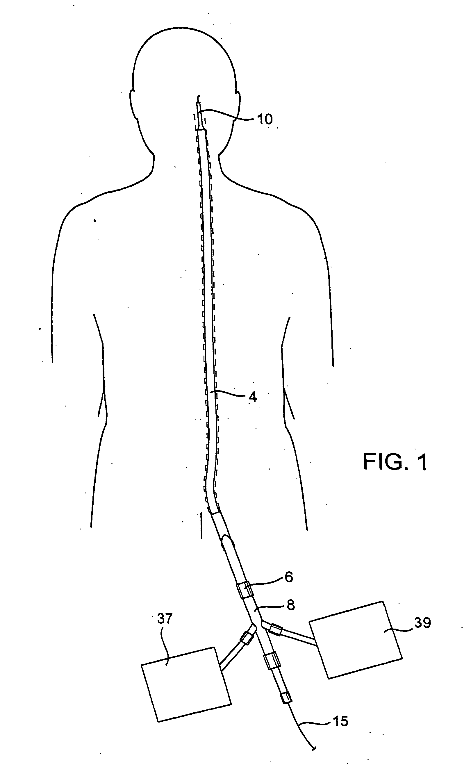 Methods and devices for protecting a passageway in a body when advancing devices through the passageway