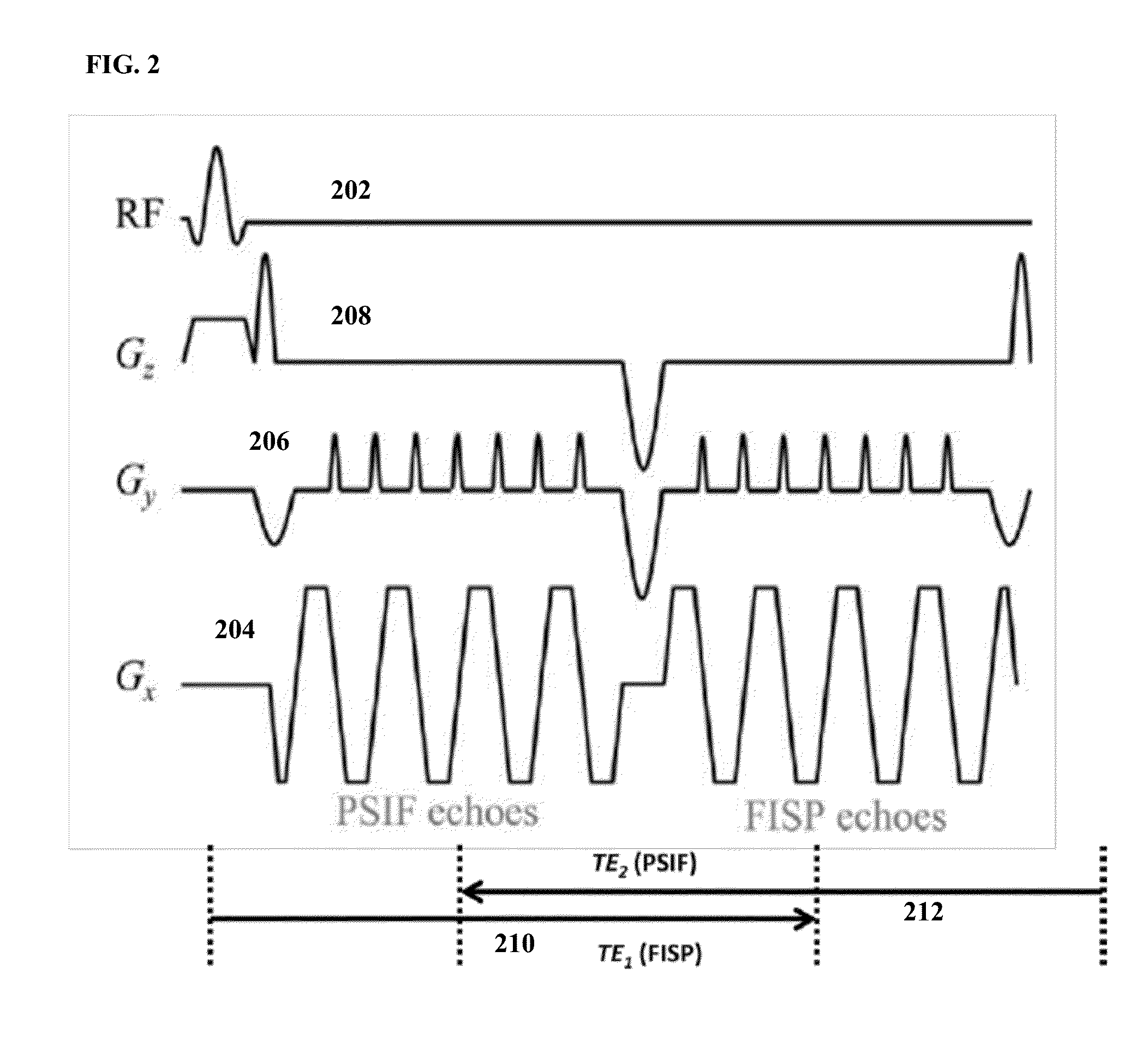 Method and System for B0 Drift and Respiratory Motion Compensation in Echo-Planar Based Magnetic Resonance Imaging