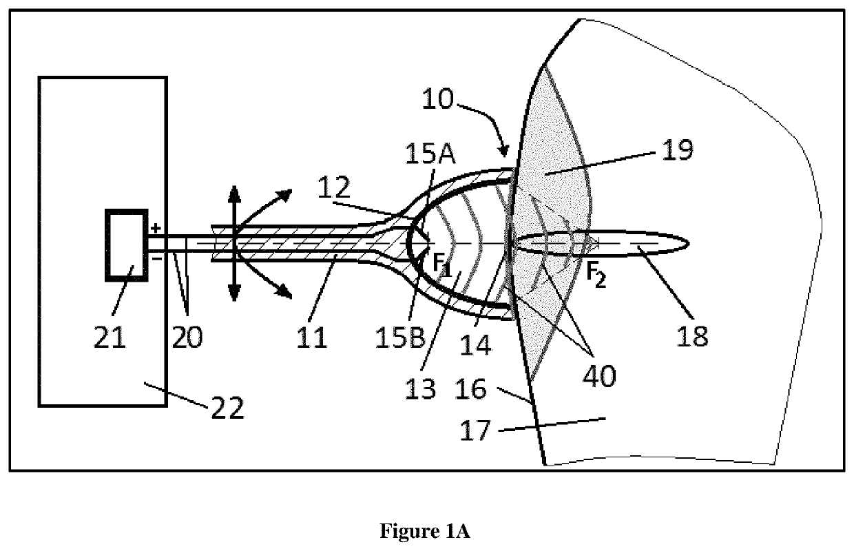 Acoustic pressure shock waves used for personalized medical treatment of tissue conditions