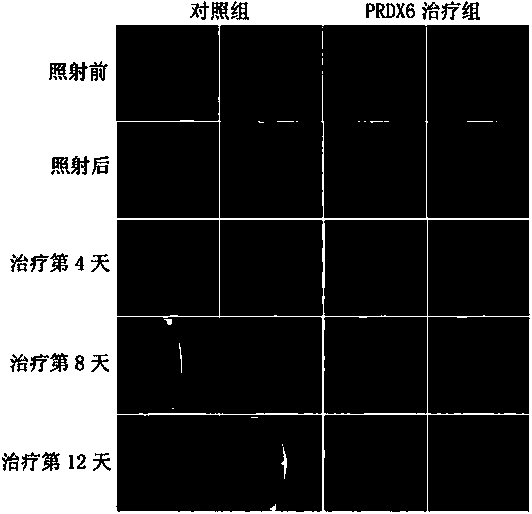 New applications of PRDX2 and/or PRDX6