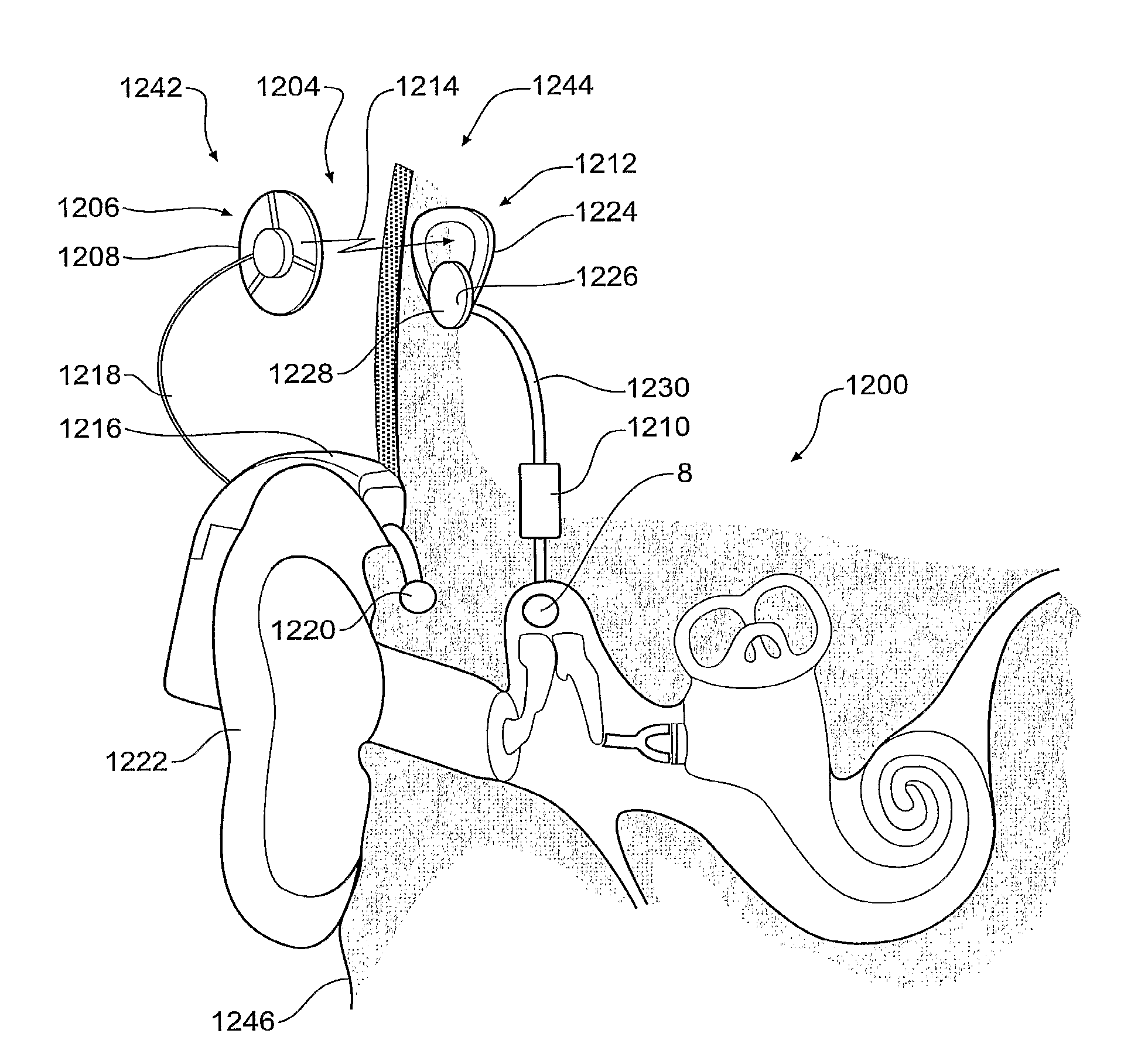 Implantable actuator for hearing aid application