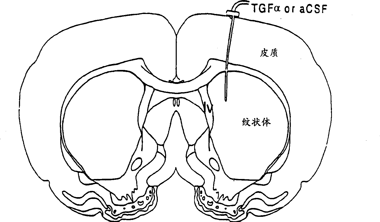 Method for treating neurological deficits