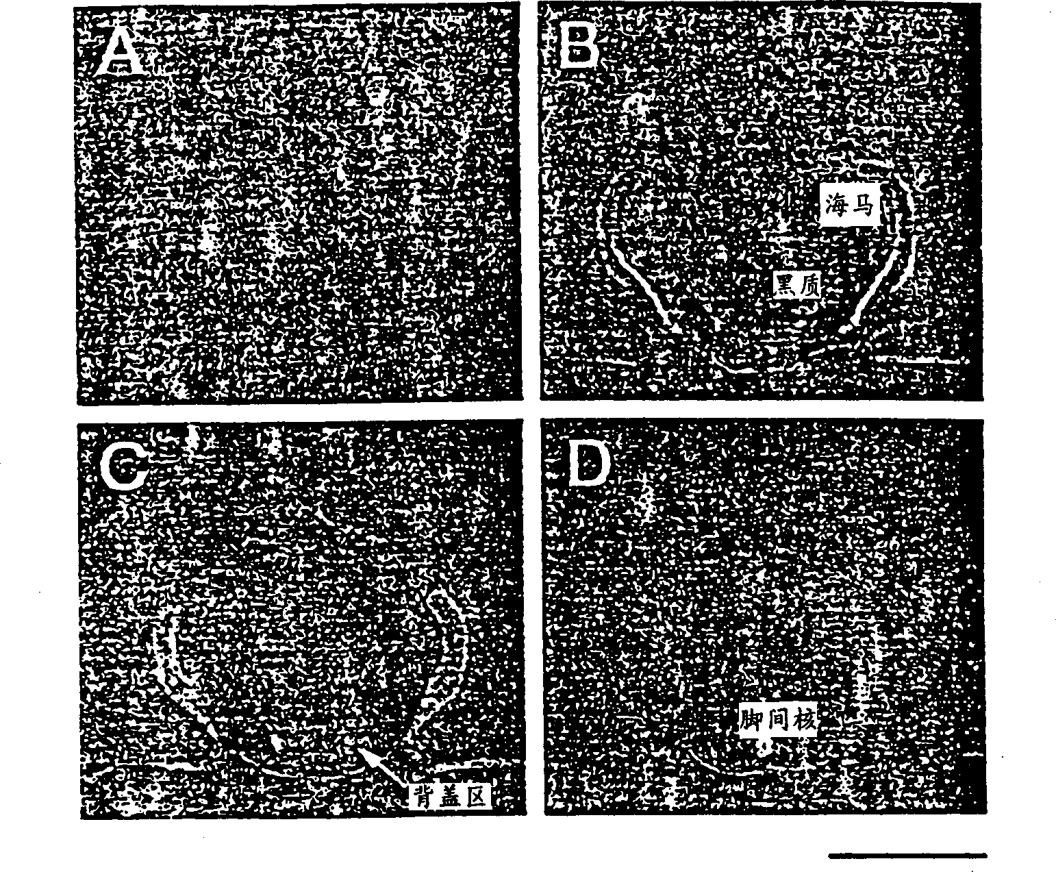 Method for treating neurological deficits