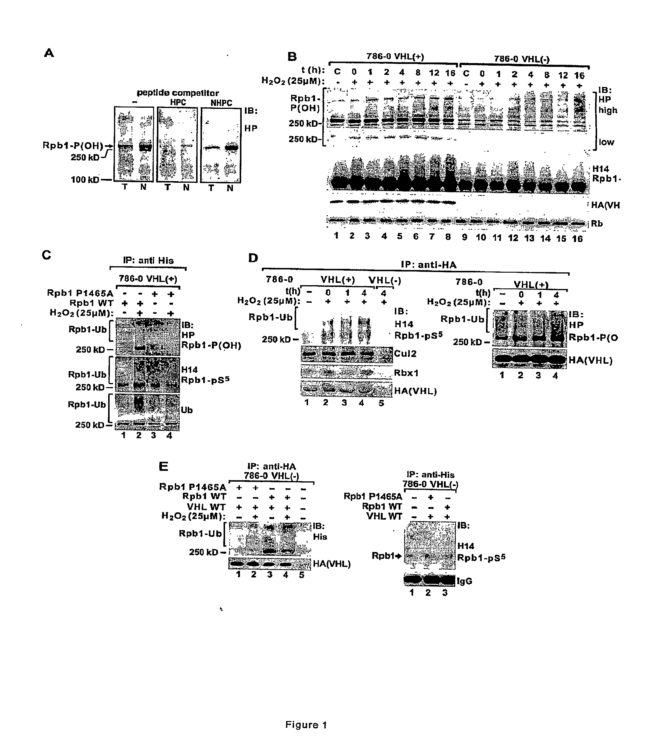 Methods for diagnosing and treating cancers via manipulations of a...pathway