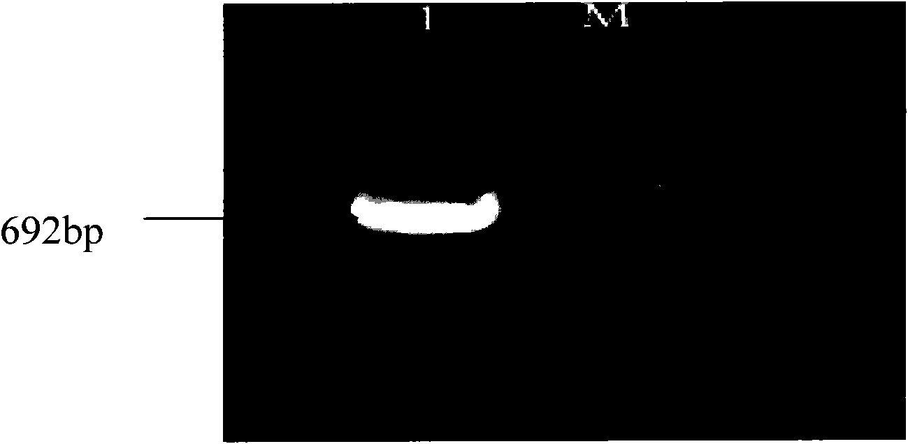 Shark angiogenesis inhibiting factor and production and purification method and application