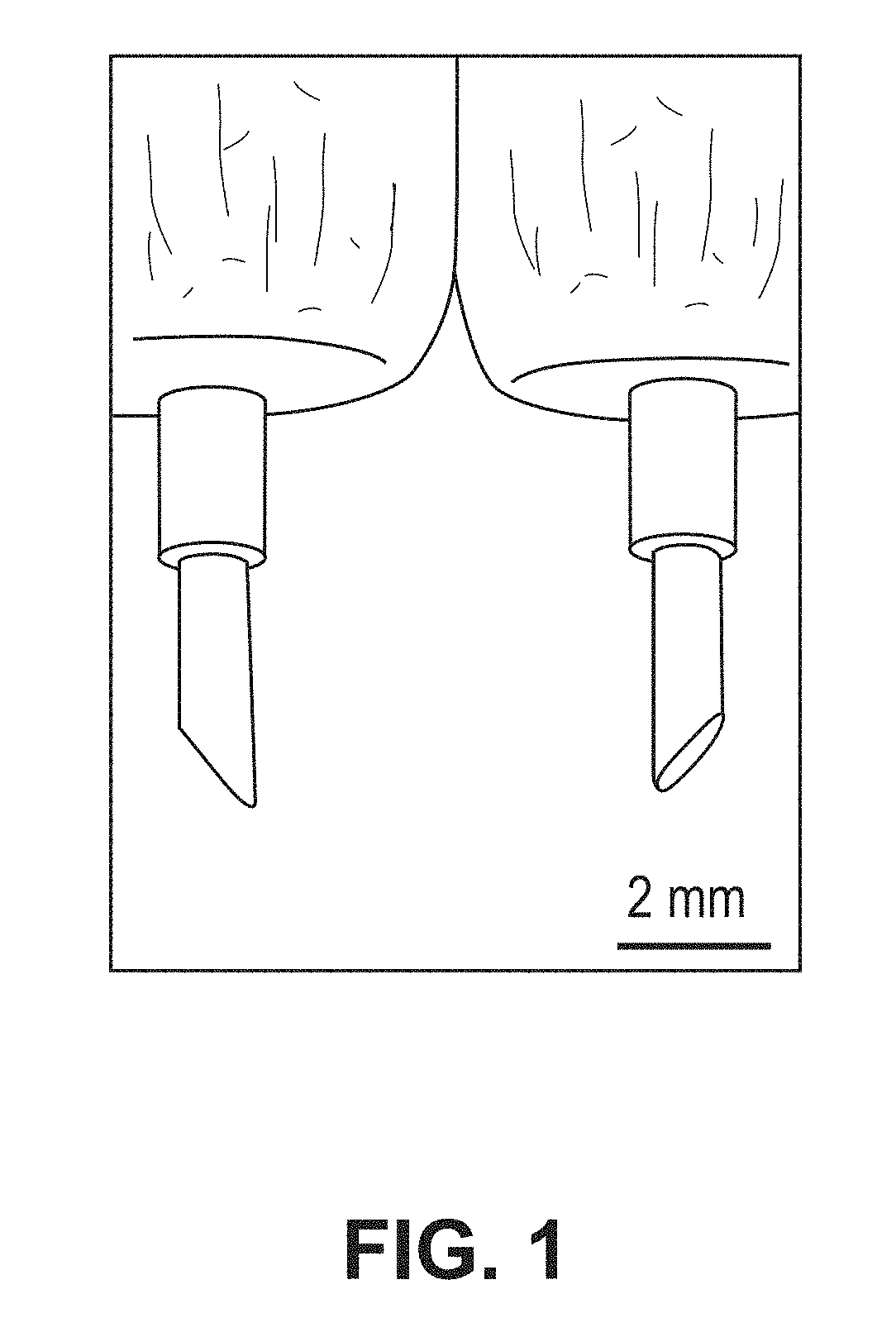 Nanoelectroablation control and vaccination