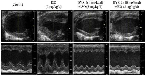 Application of DYZ-9 in preparation of anti-cardiac hypertrophy product