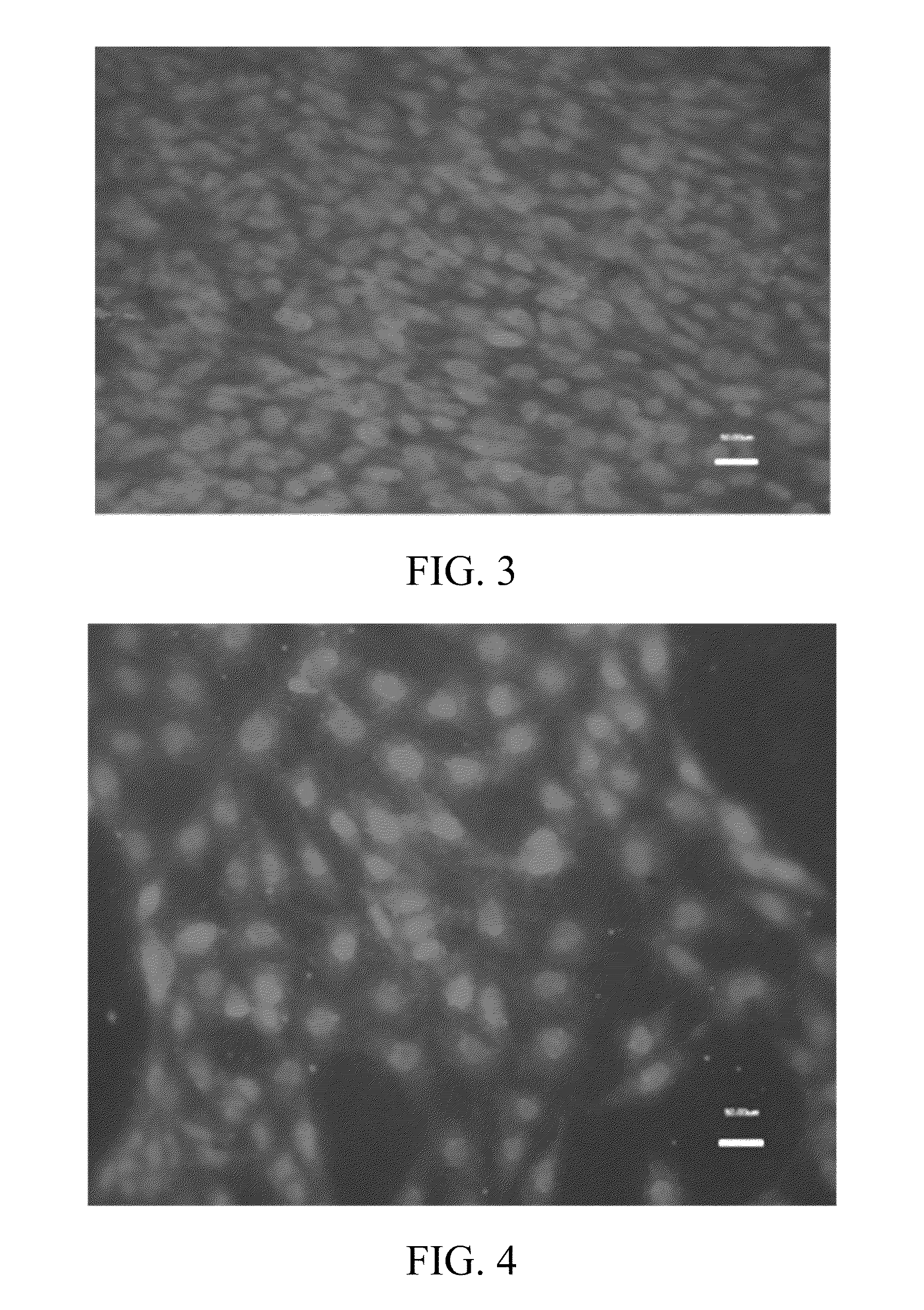 Novel nitinol alloys and uses thereof in surgical implants