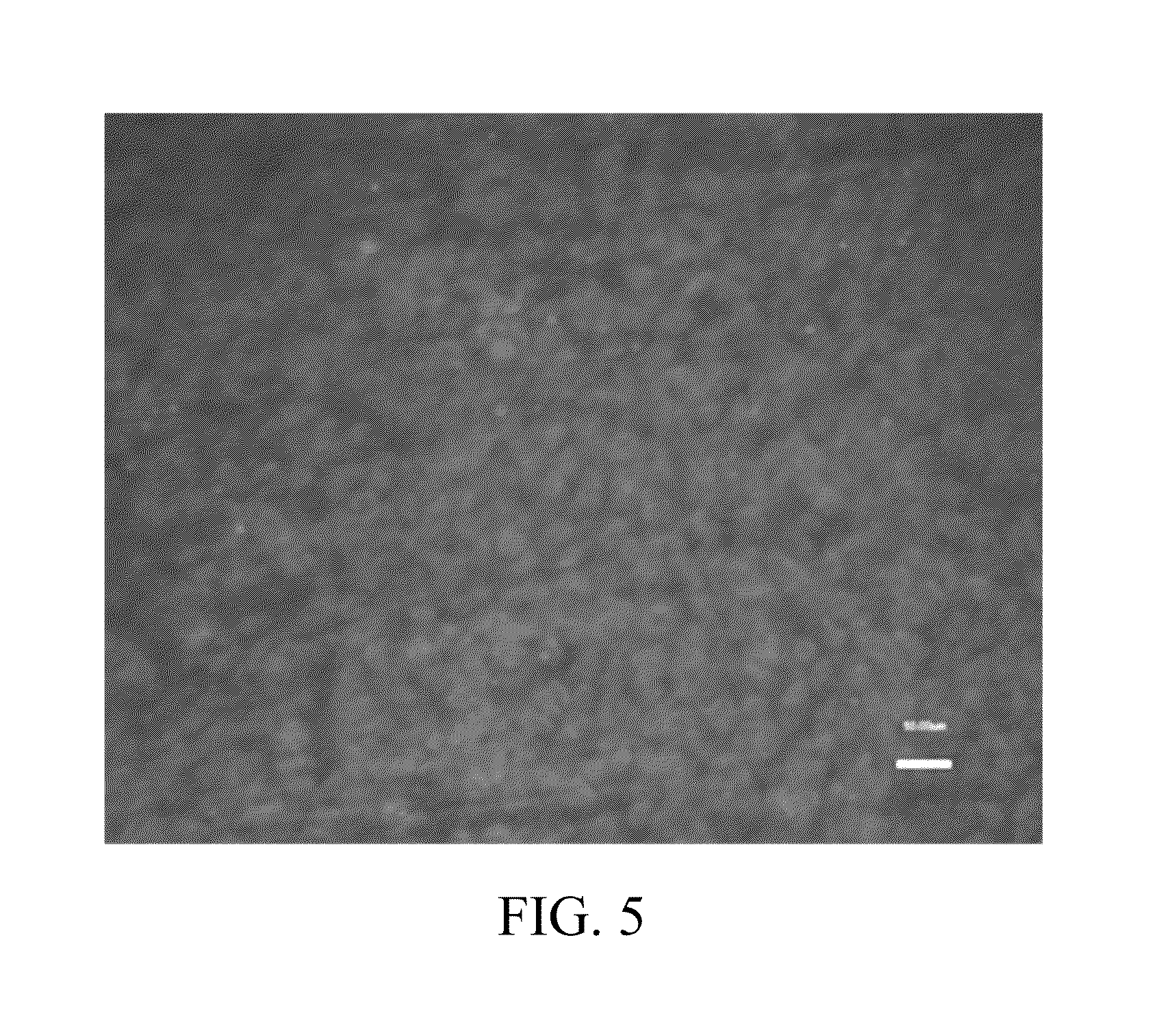 Novel nitinol alloys and uses thereof in surgical implants