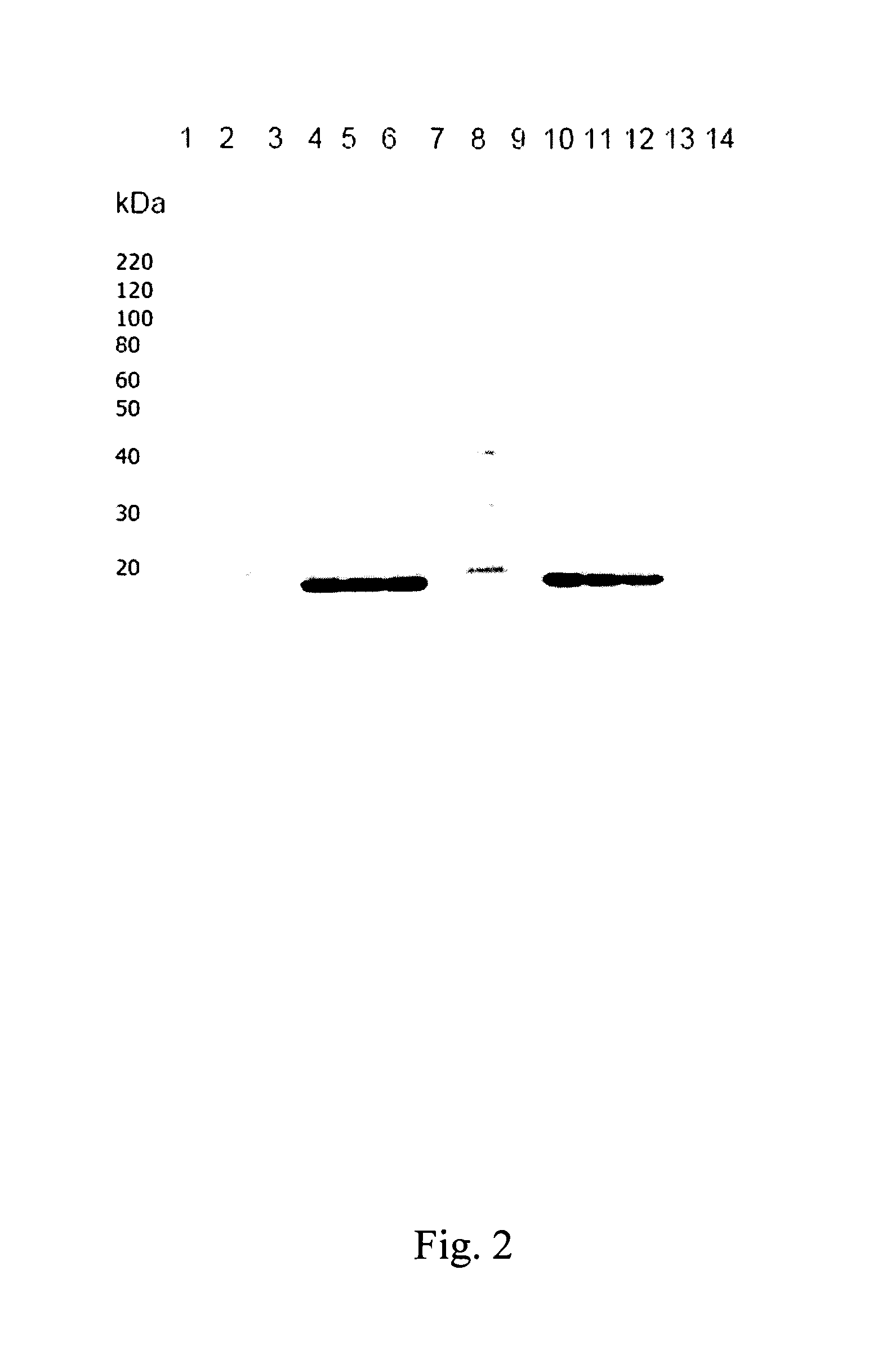 Method for obtaining biologically active recombinant human g-csf