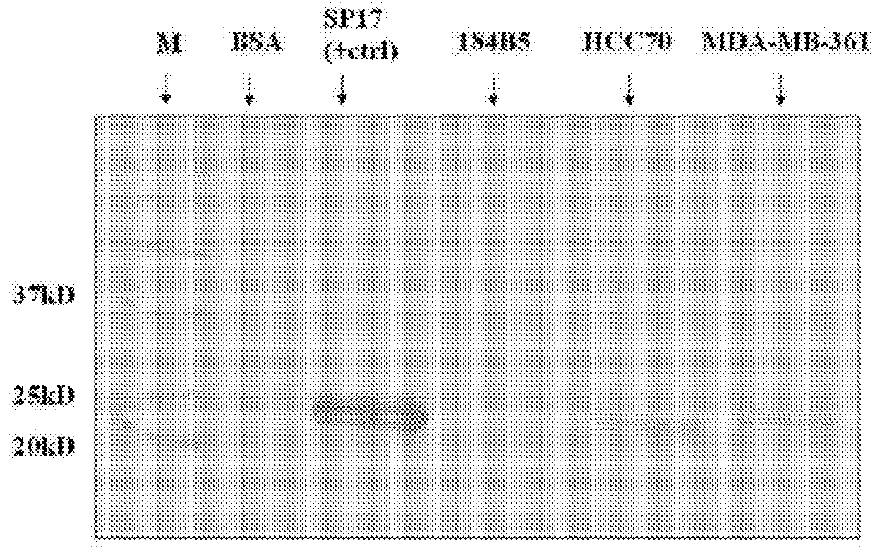 Cancer testis antigen sperm protein 17 as a target for breast cancer immunotherapy and diagnosis