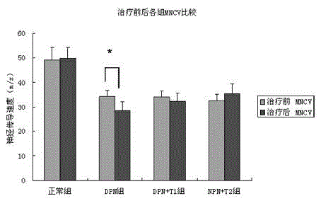 Application of tnf-alpha receptor-antibody fusion protein in preparation of medicine for treating diabetic peripheral neuropathy