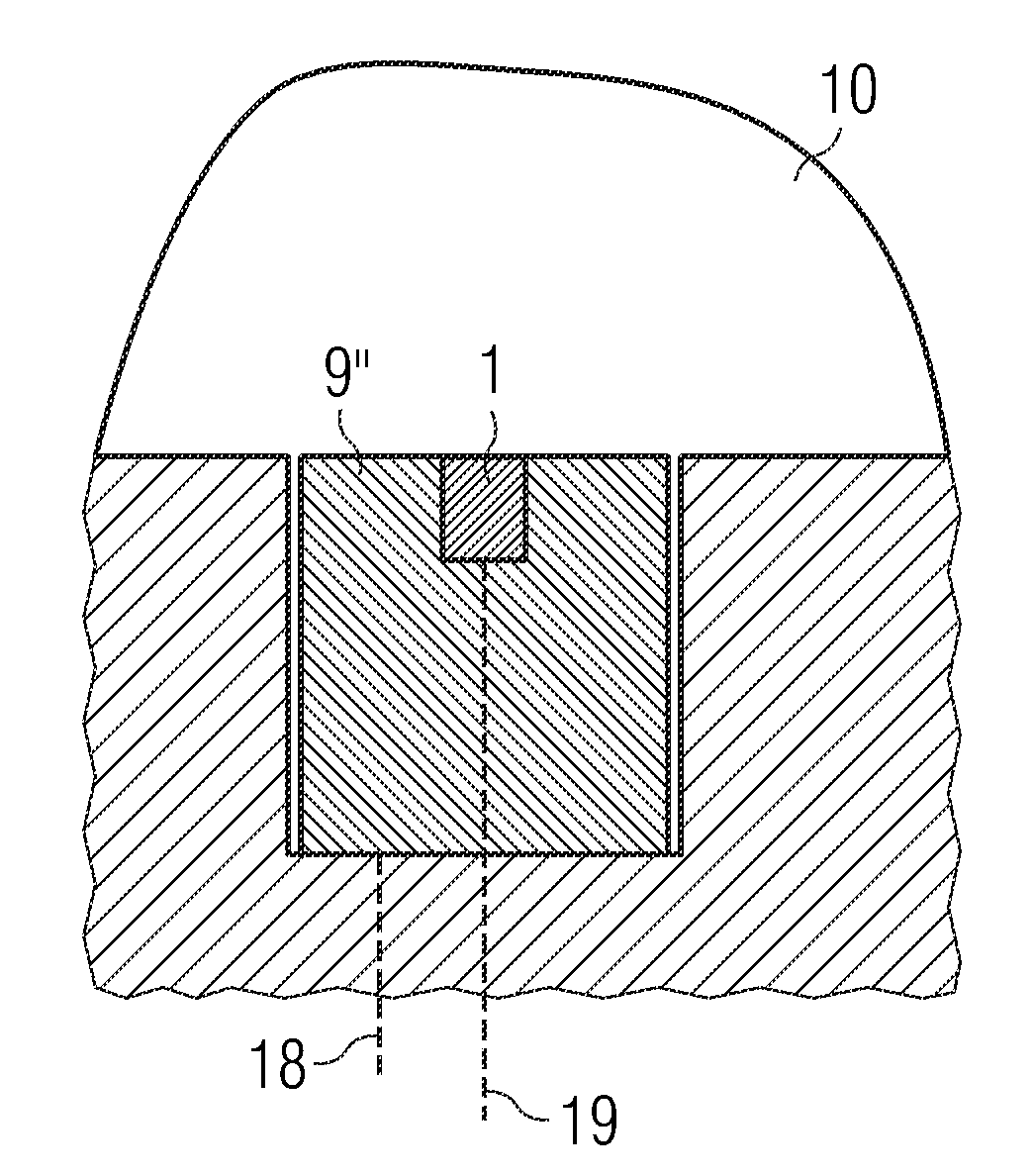 Method and device for actively suppressing pressure oscillations in a hydraulic system