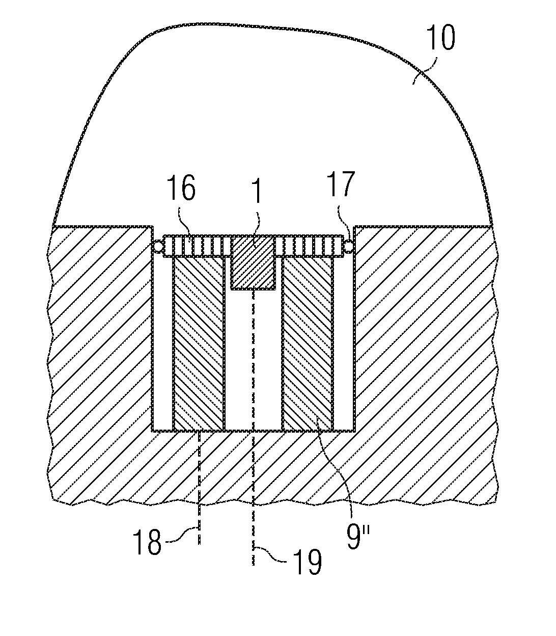 Method and device for actively suppressing pressure oscillations in a hydraulic system