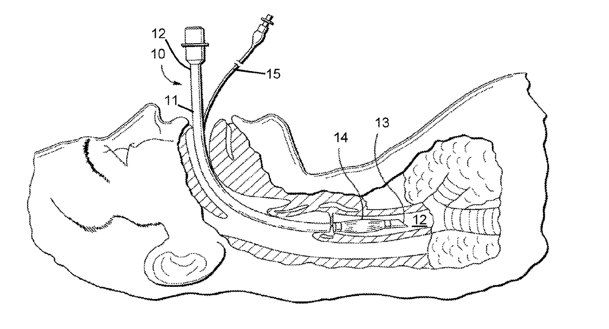 Airway maintenance device