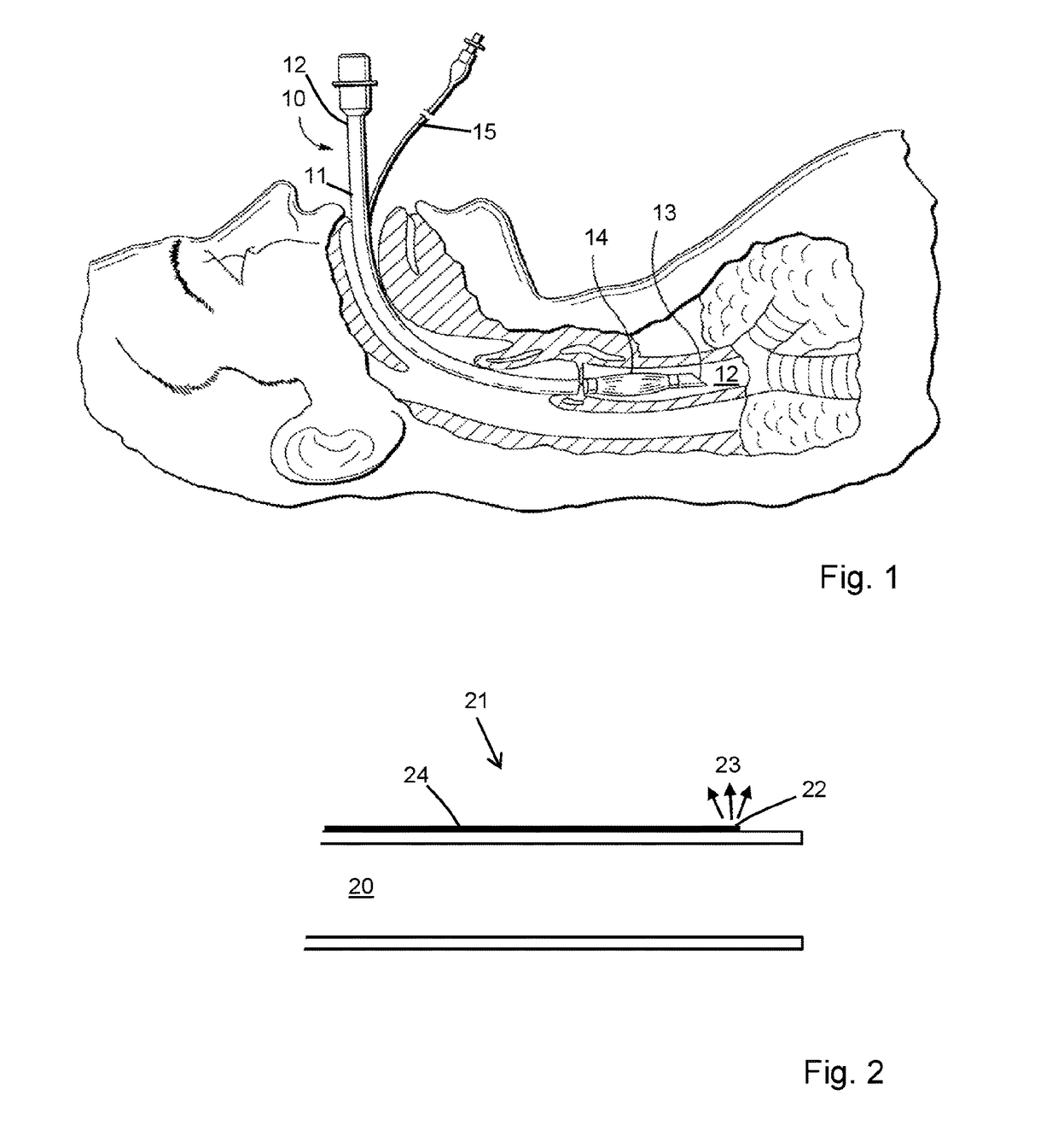 Airway maintenance device