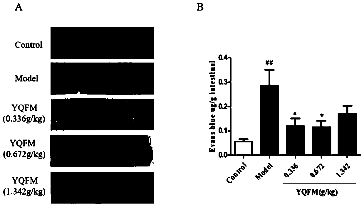 Application of qi-tonifying and pulse-restoring (freeze-drying) or ruscogenin for injection in prevention of pharmaceutical organ hemorrhage